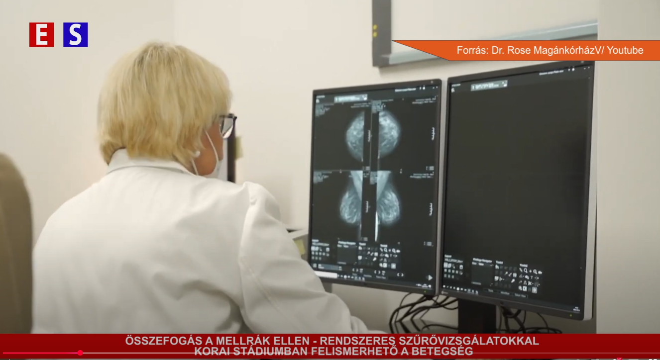 Összefogás a mellrák ellen – rendszeres szűrővizsgálatokkal korai stádiumban felismerhető a betegség